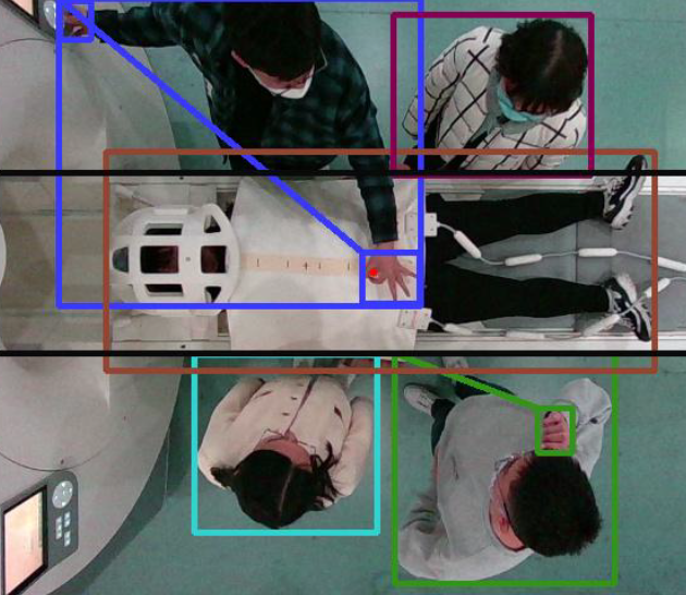 Paper Teaser - Automated Patient Positioning with Learned 3D Hand Gestures