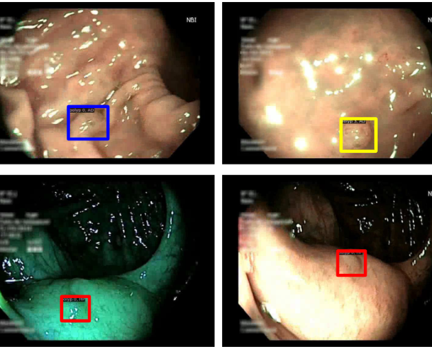Paper Teaser - Unified Foundation Model for Colonoscopy Video Analysis