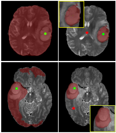 Paper Teaser - Results of Proposed Method on Brain MRI